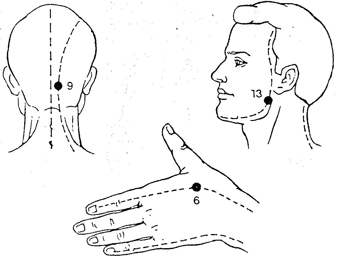 Какие точки есть. Акупрессура точечный массаж акупунктура. Точки акупрессуры при зубной боли. Точечный массаж (точки Жень-Чжун. Чэн-Цзян).. Акупрессура точечный массаж китайской медицины.